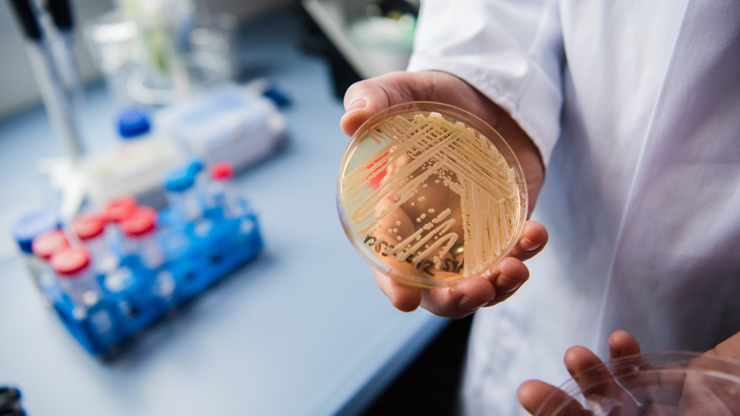 New study reveals why dangerous fungus is so difficult to treat — KTVU FOX 2 Bay Area, Moraga Community news